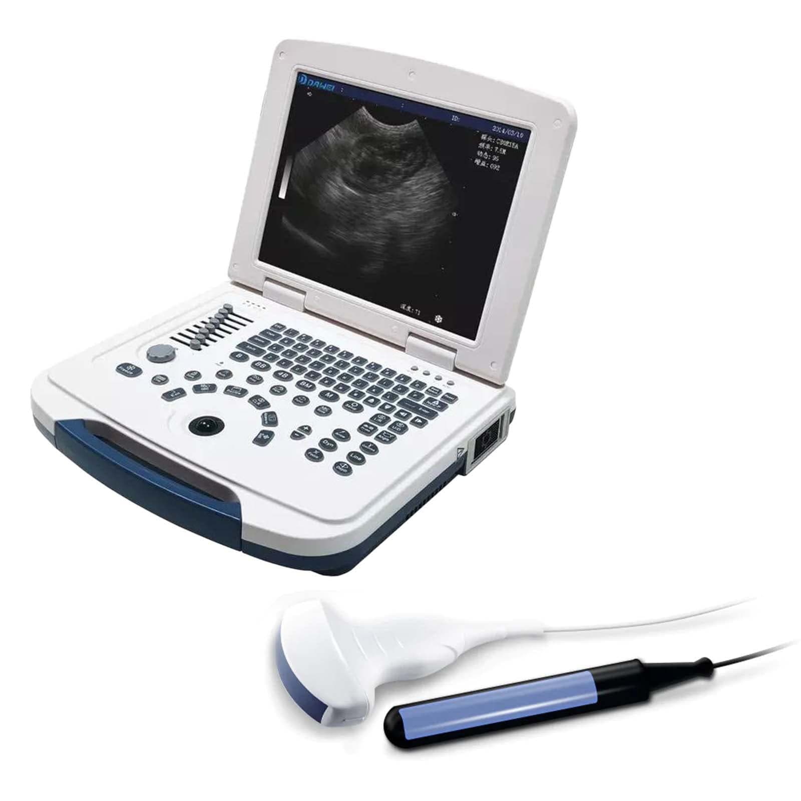 Portable Ultrasound Machine
